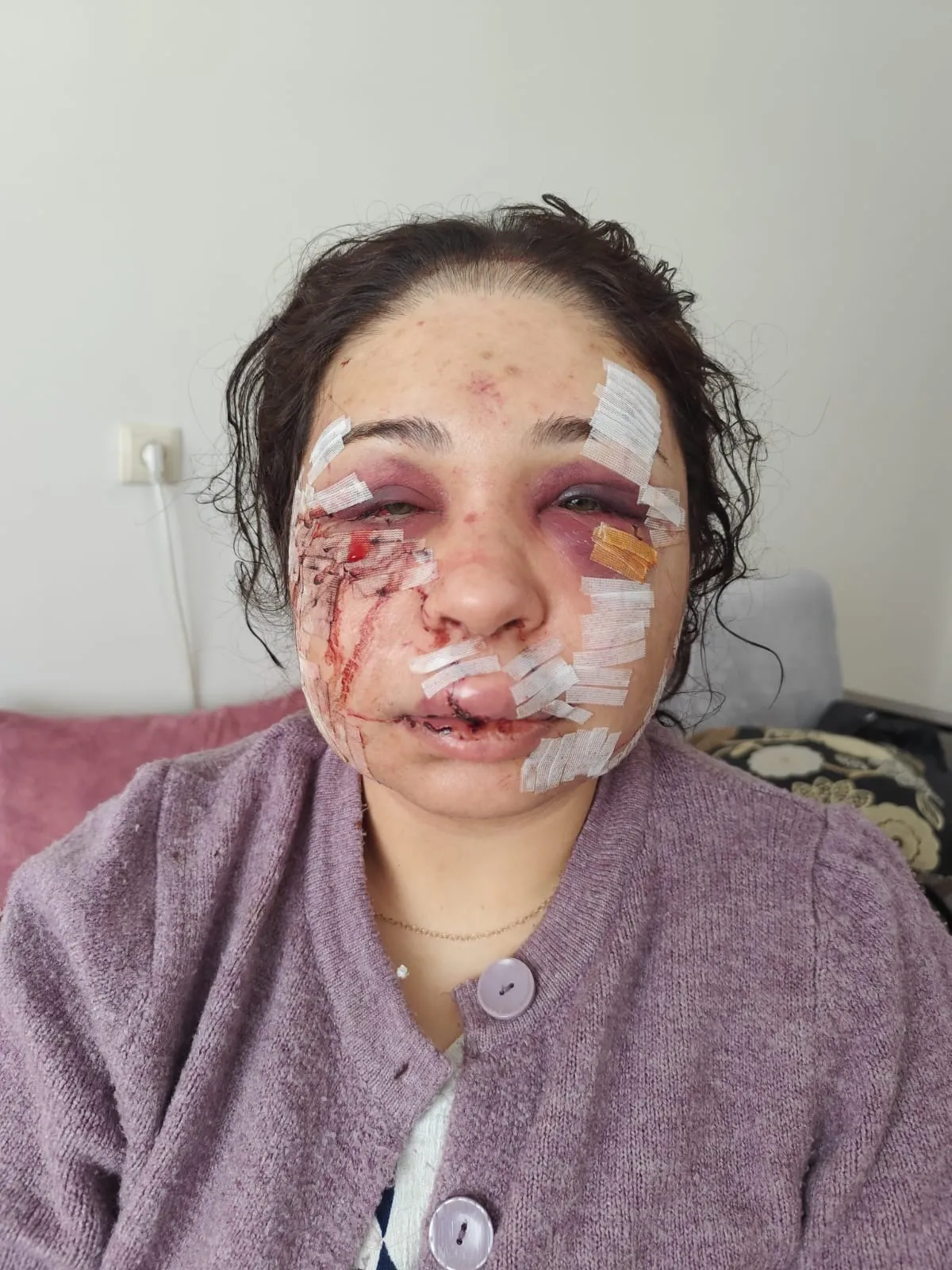 Eşini ağır yaralayan polise hapis cezası ve tahliye kararı