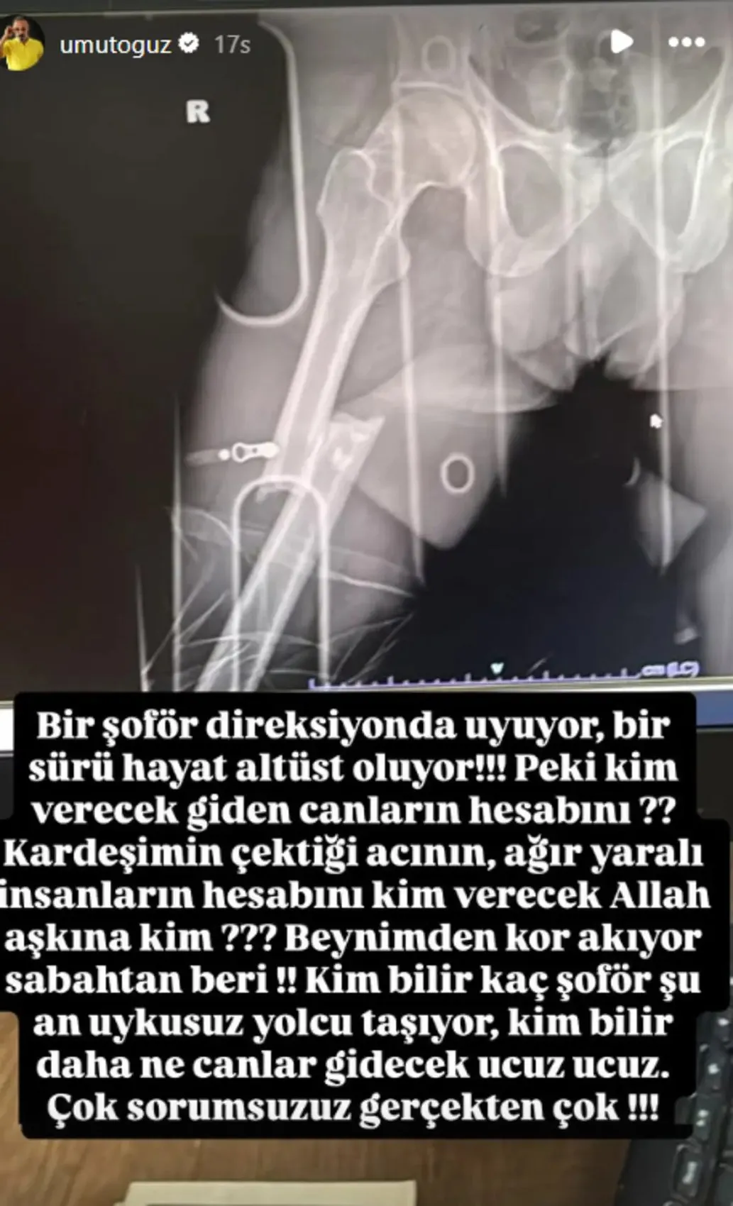 Okan Oğuz Daha 17 için yola çıkmıştı! Abi Umut Oğuz kazanın detaylarını öğrenince isyan etti 4