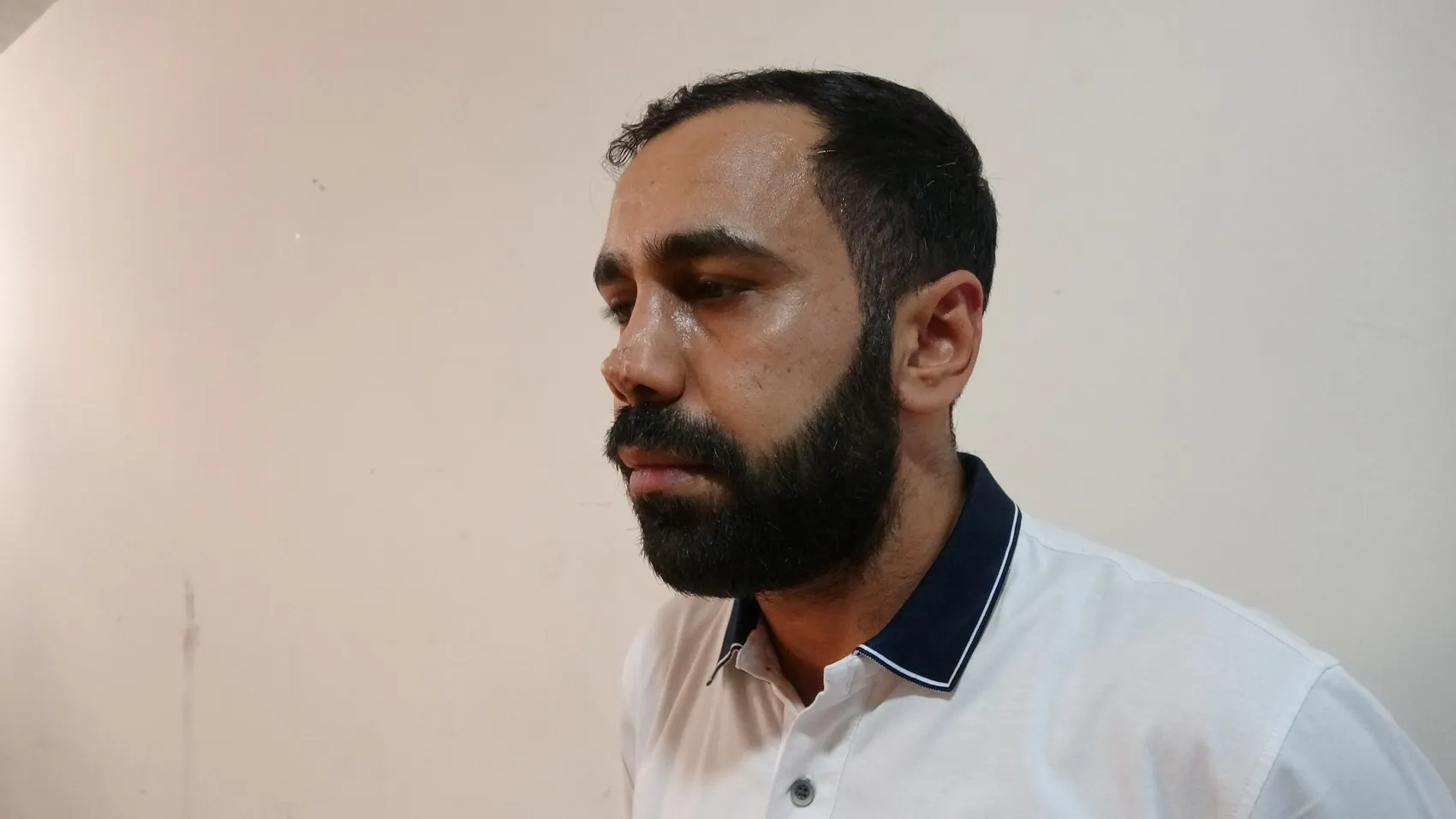 Estetik ameliyat sonrası yüzünde iz kalan hasta hastaneye dava açtı