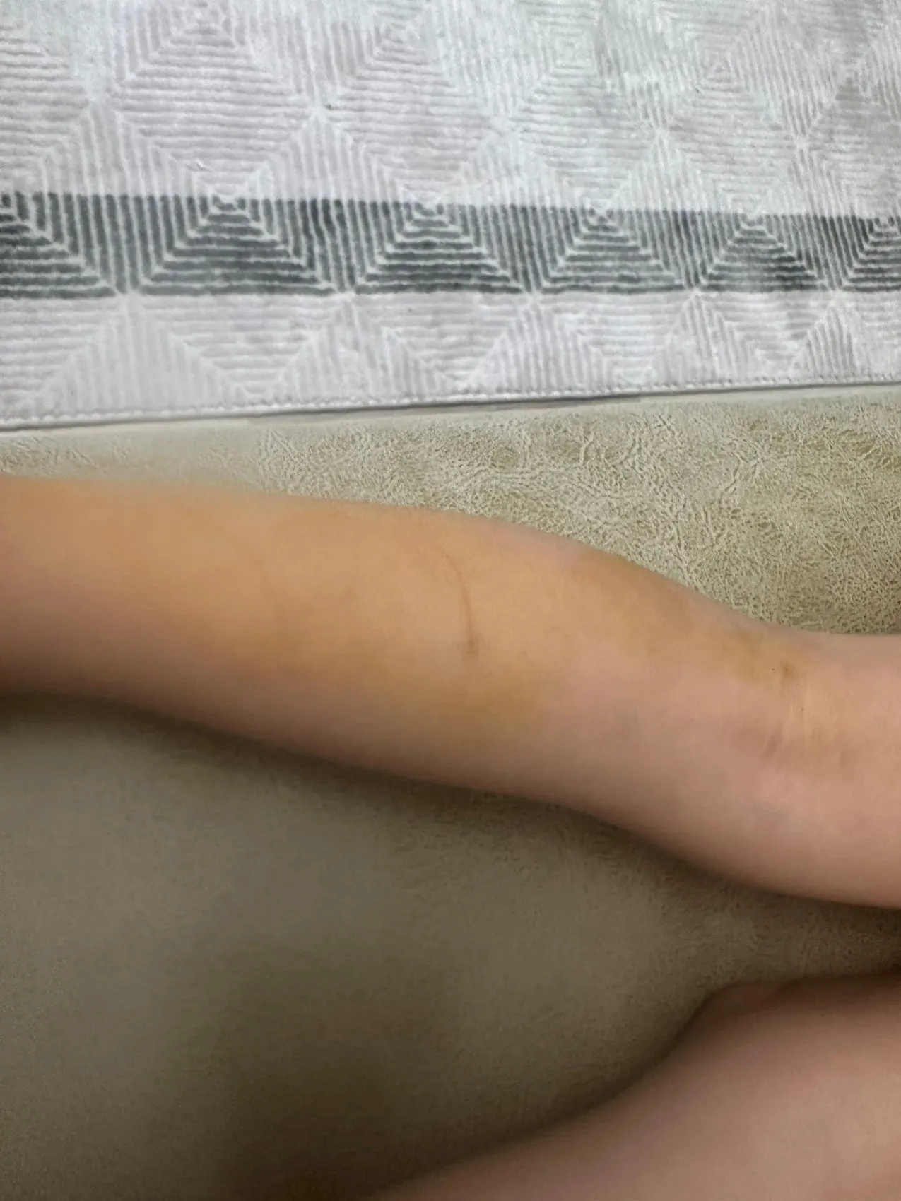 Halfeti'de üç yaşındaki çocuğa sokak köpeği saldırdı
