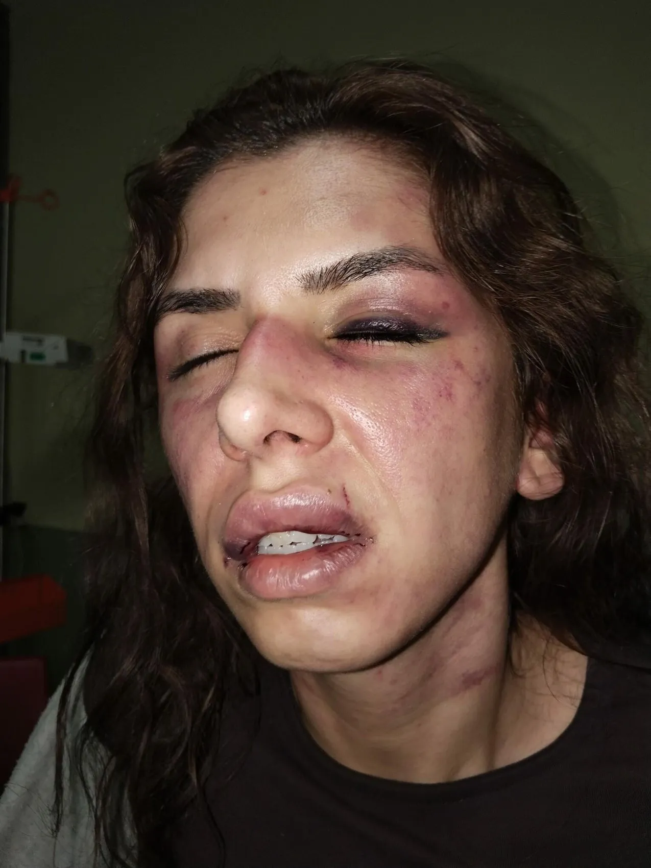 Kabus dolu dört saat: Ölümün kıyısından dönen genç annenin adalet çığlığı