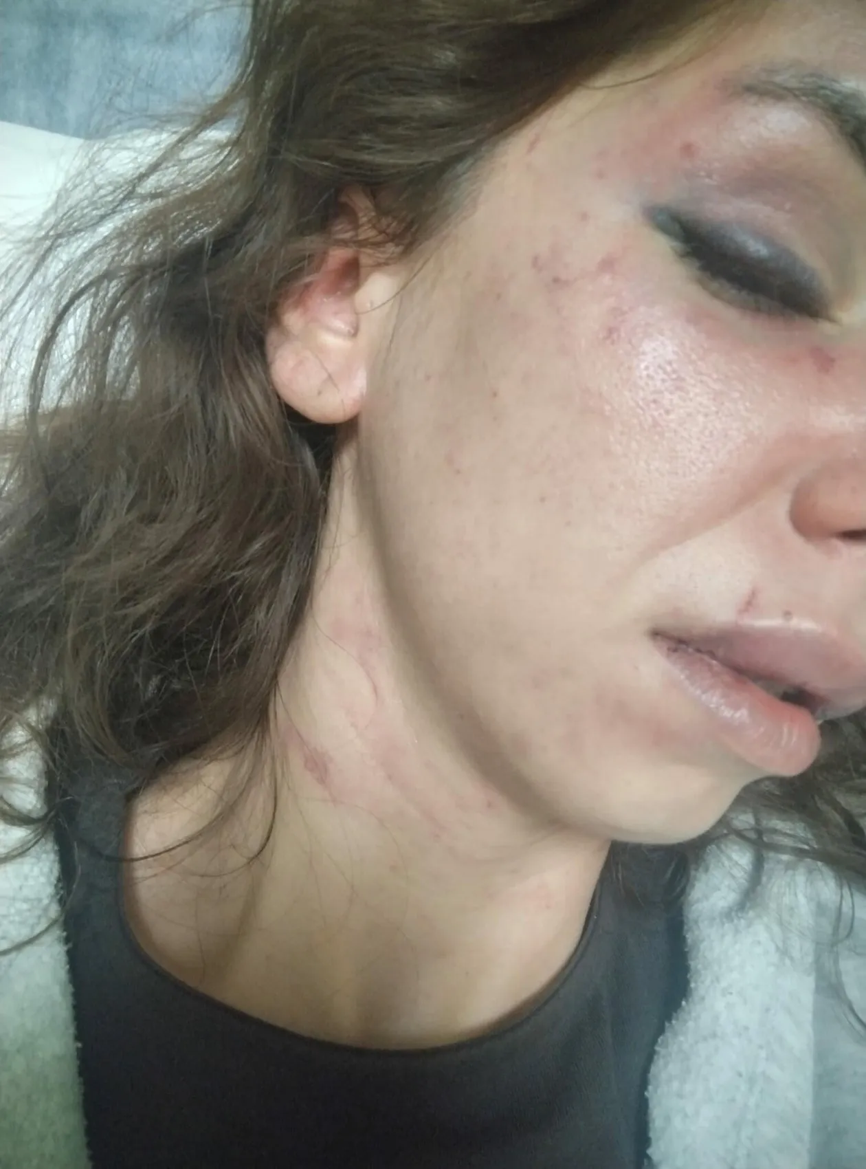 Kabus dolu dört saat: Ölümün kıyısından dönen genç annenin adalet çığlığı