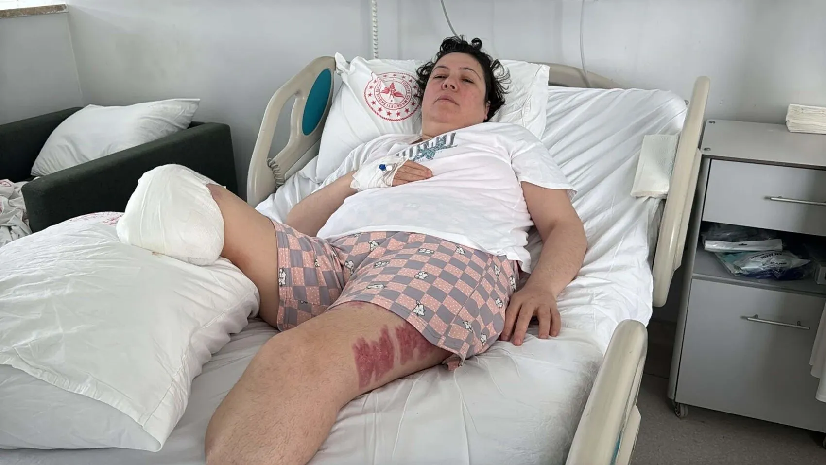 İki bacağını kaybettiği saldırı sonrası sanıktan kan donduran savunma: Sevdiğim için yaptım