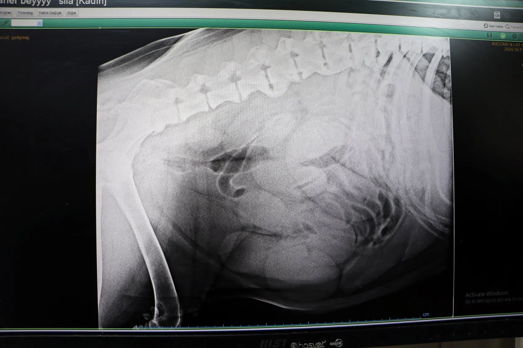 Adana'da korkutan operasyon: Köpeğinin karnından kendi ağırlığının yüzde 15'i kadar kitle çıktı