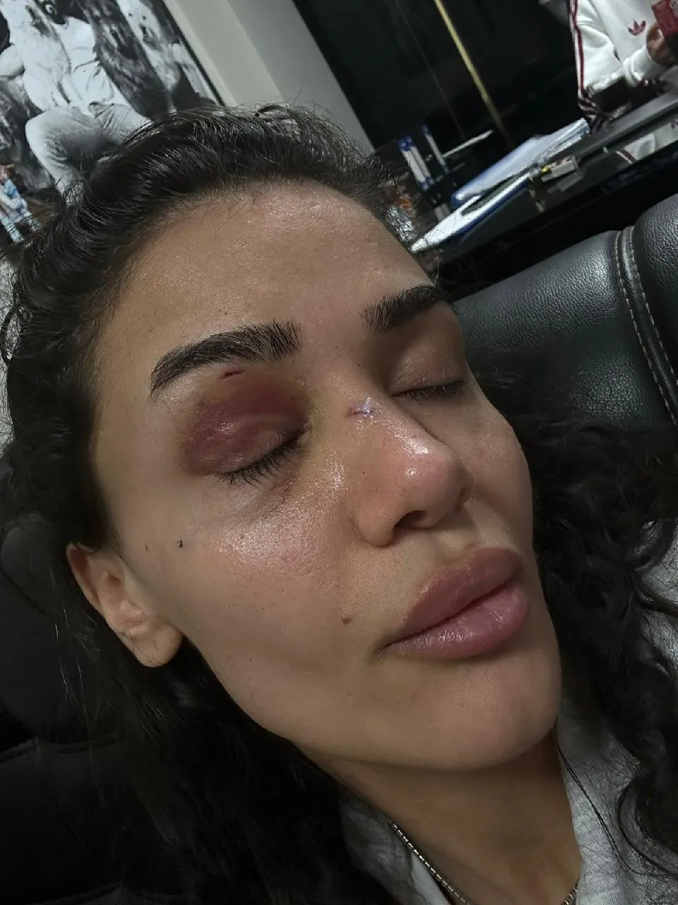 Uzaklaştırma kararı kalkan olmadı: Hemşire Ebru'nun çaresiz haykırışı