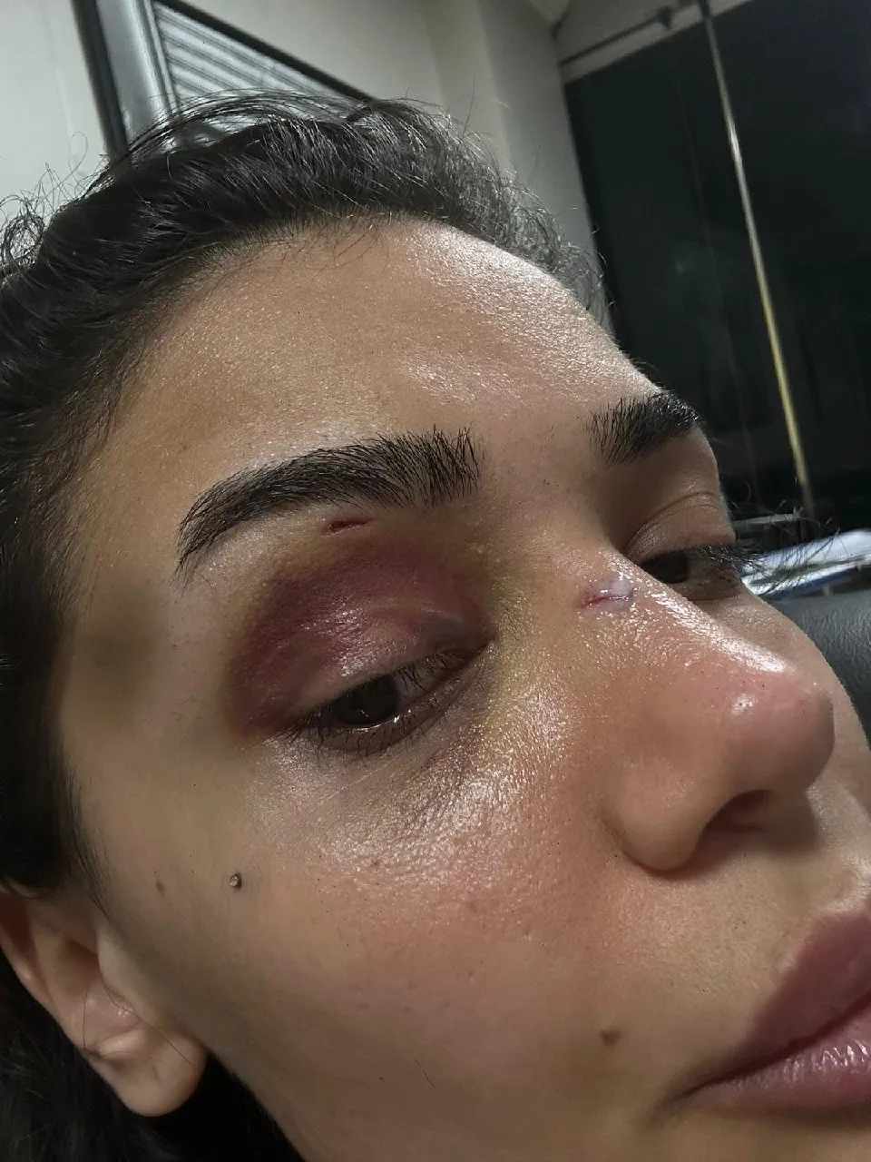 Uzaklaştırma kararı kalkan olmadı: Hemşire Ebru'nun çaresiz haykırışı