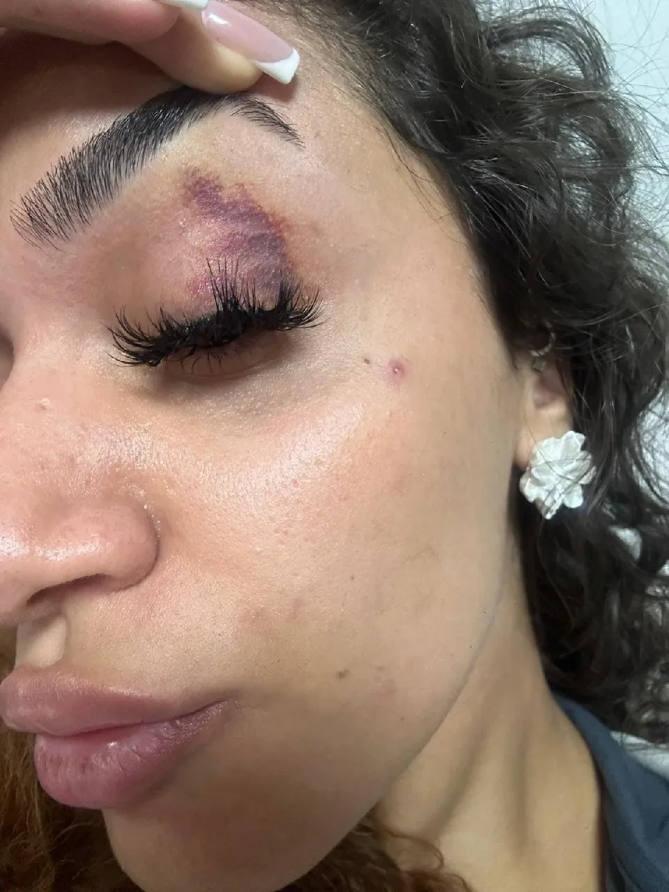 Uzaklaştırma kararı kalkan olmadı: Hemşire Ebru'nun çaresiz haykırışı