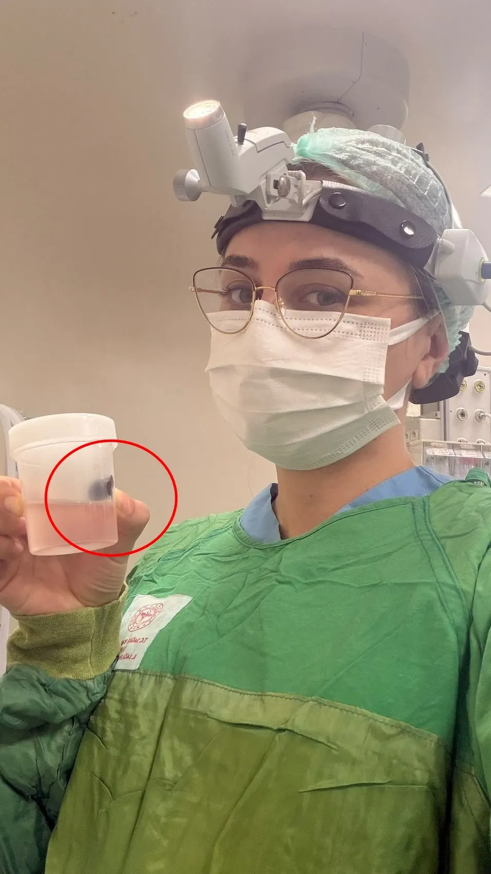 Siirt'te korkutan vaka: Küçük çocuğun boğazından canlı sülük çıkarıldı