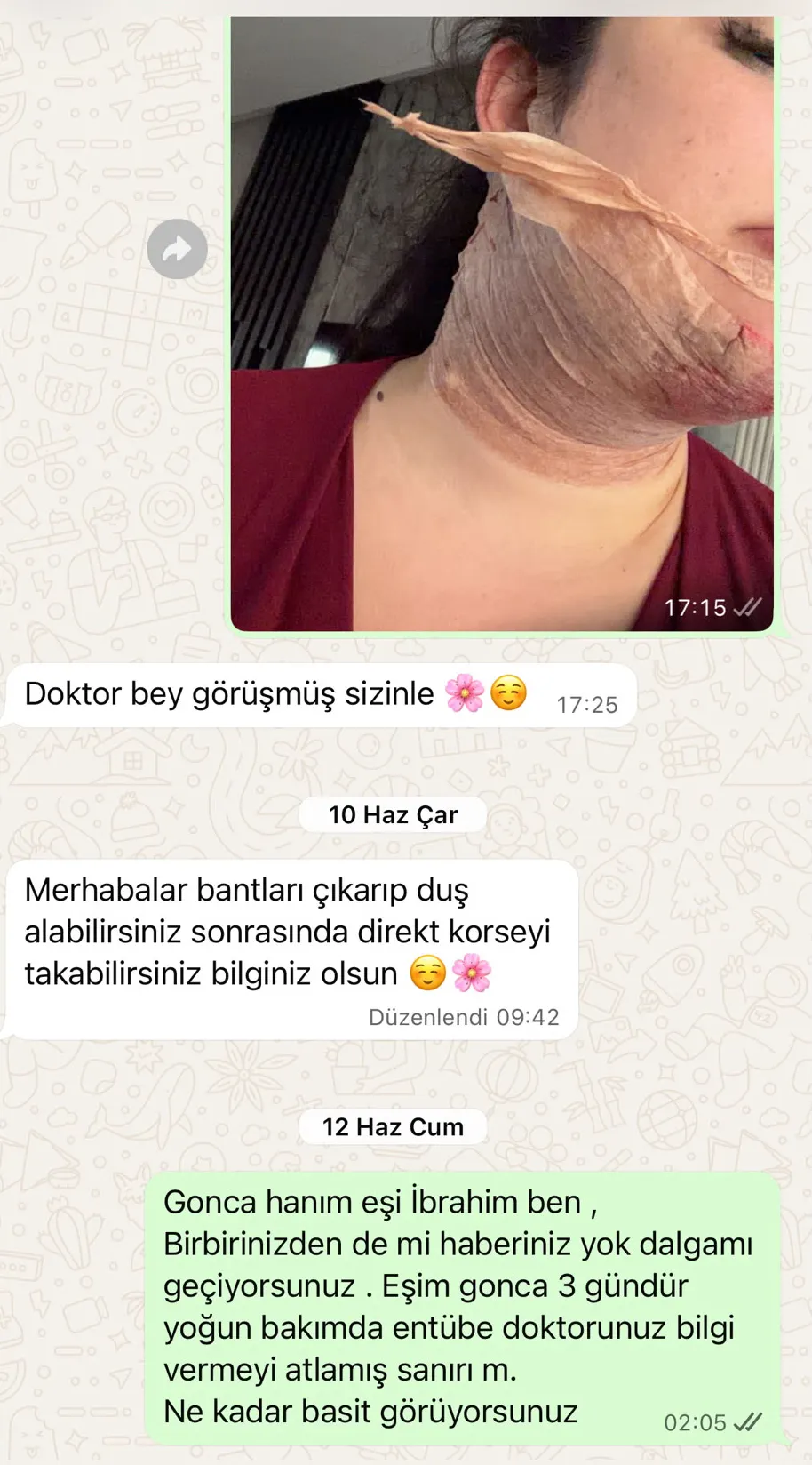 Güzelleşmek isterken ölümden döndü: Estetik operasyon sonrası kabus dolu günler