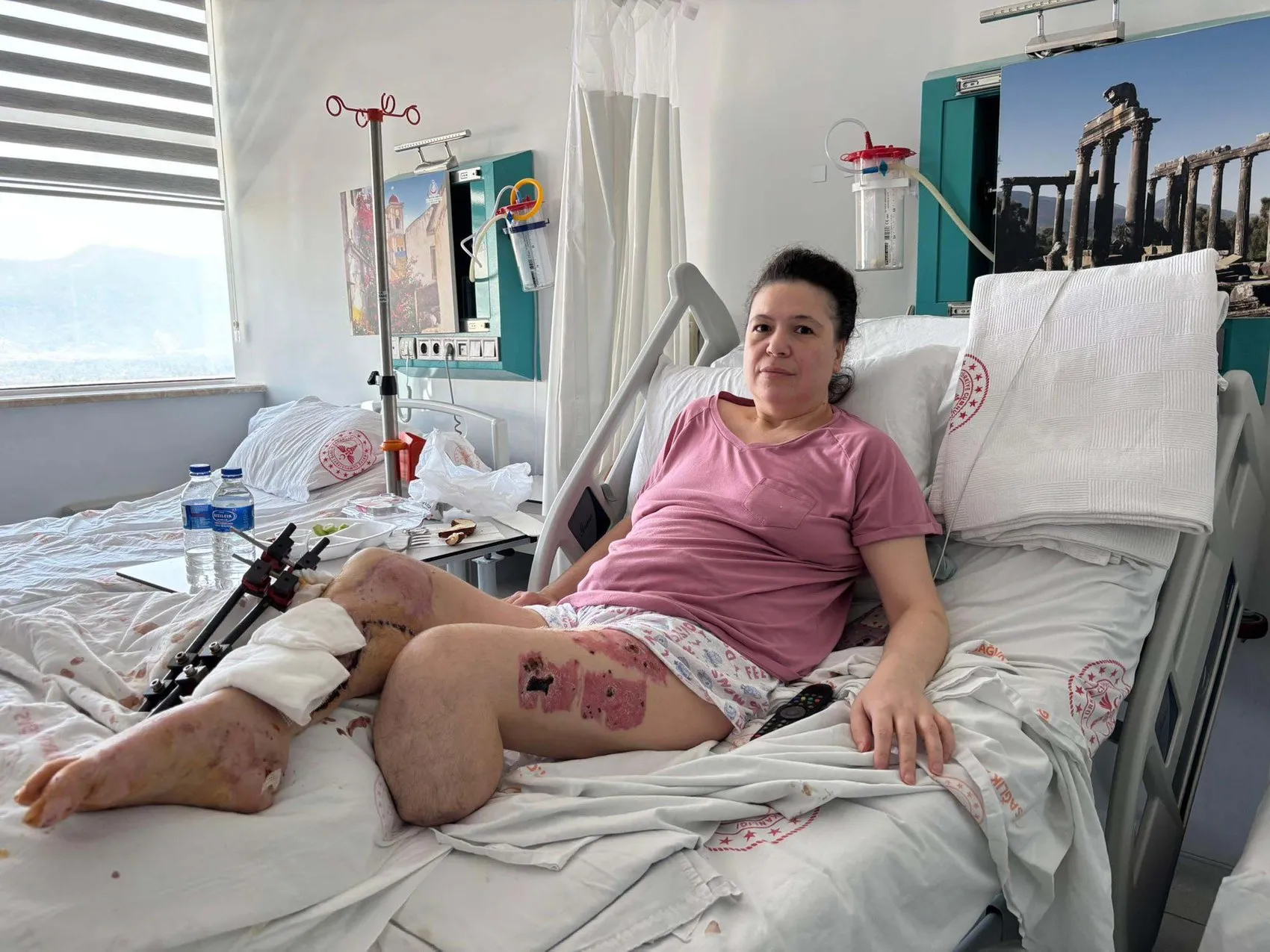 İki bacağını kaybettiği saldırı sonrası sanıktan kan donduran savunma: Sevdiğim için yaptım